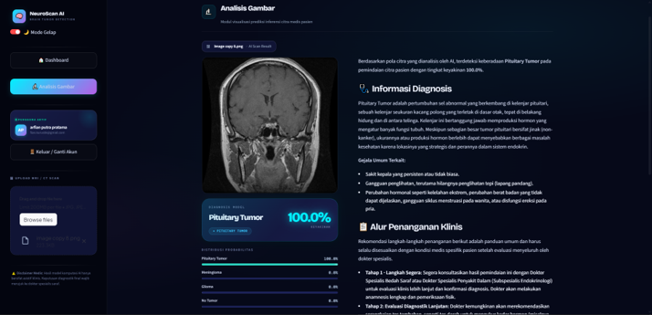NeuroScan AI